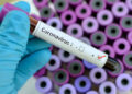 US mortality data indicates COVID-19 death toll nearly double reported toll