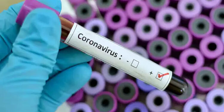 Covid-19 recovery rate improves to 87.36 per cent