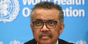 Thousands more underfed children may die due to COVID-19: WHO