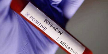 COVID-19 recovery rate stands at 83.84 per cent