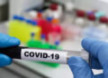 Study sheds light on potential allergic reactions of Coronavirus vaccines
